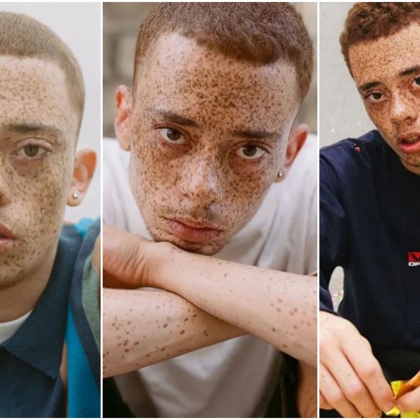 Необичниот изглед го однесе во светот на модата: Децата ме гледаат и прашуваат зошто имам точки по лицето (ФОТО)